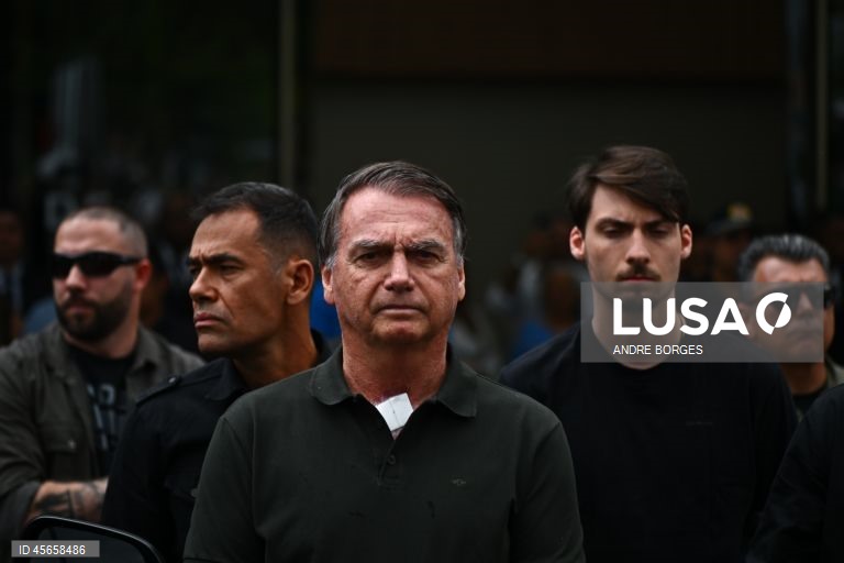 Bolsonaro tem um problema renal e vai permanecer hospitalizado